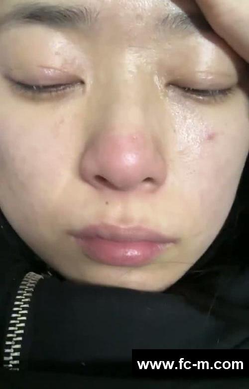 120-105|瘦15斤面部折叠度都变了